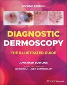 Pozostałe książki - BLACKWELL PUBL Diagnostic Dermoscopy - The Illustrated Guide - miniaturka - grafika 1