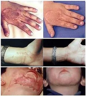 Elicina Elicina - Krem ze śluzu ślimaka 40g WYSYŁKA GRATIS - Kremy do twarzy - miniaturka - grafika 4