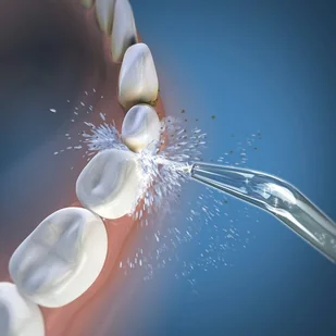 Waterpik WJT-2E klasyczne końcówki do IRYGATORA WF-05,06 - 2 szuki - Końcówki do irygatorów - miniaturka - grafika 3