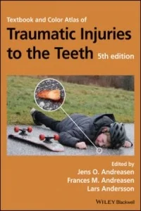 Textbook and Color Atlas of Traumatic Injuries to the Teeth - Pozostałe książki Textbook and Color Atlas of Traumatic Injuries to the Teeth - Pozostałe książki - miniaturka - grafika 1