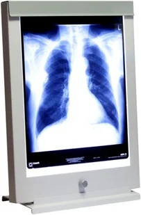 Ultra-Viol Sp.j NGP-11 Ultra Slim LED negatoskop biurkowy z ekranem 36x43cm LED NGP 11 biurko - Meble i wyposażenie gabinetów medycznych Ultra-Viol Sp.j NGP-11 Ultra Slim LED negatoskop biurkowy z ekranem 36x43cm LED NGP 11 biurko - Meble i wyposażenie gabinetów medycznych - miniaturka - grafika 1