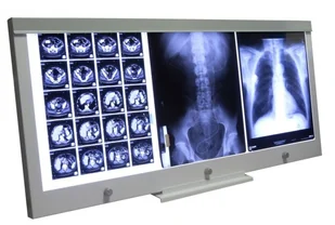 Ultra-Viol Sp.j NGP-31 Ultra Slim LED negatoskop biurkowy z ekranem 108x43cm LED NGP 31 biurko - Meble i wyposażenie gabinetów medycznych Ultra-Viol Sp.j NGP-31 Ultra Slim LED negatoskop biurkowy z ekranem 108x43cm LED NGP 31 biurko - Meble i wyposażenie gabinetów medycznych - miniaturka - grafika 1