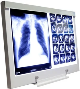 Ultra-Viol Sp.j NGP-21 Ultra Slim LED negatoskop biurkowy z ekranem 72x43cm LED NGP 21 biurko - Meble i wyposażenie gabinetów medycznych Ultra-Viol Sp.j NGP-21 Ultra Slim LED negatoskop biurkowy z ekranem 72x43cm LED NGP 21 biurko - Meble i wyposażenie gabinetów medycznych - miniaturka - grafika 1