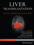 Pozostałe książki - BLACKWELL PUBL Liver Transplantation - miniaturka - grafika 1