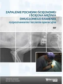 Książki medyczne - Zapalenie pochewki ścięgnowej i ścięgna mięśnia dwugłowego ramienia - rozpoznawanie i leczenie operacyjne - miniaturka - grafika 1