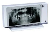 Urządzenia medyczne - Ultraviol Negatoskop PANORAM 01 Negatoskop pantomograficzny - miniaturka - grafika 1