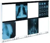 Meble i wyposażenie gabinetów medycznych - Ultra-Viol Sp.j NGP-80 HF negatoskop 8-klatkowy mobilny ze statywem NGP-80 HF + statyw - miniaturka - grafika 1