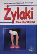 Książki medyczne - Żylaki i inne choroby żył Używana - miniaturka - grafika 1