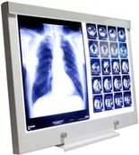 Meble i wyposażenie gabinetów medycznych - Ultra-Viol Sp.j NGP-21 Ultra Slim LED negatoskop biurkowy z ekranem 72x43cm LED NGP 21 biurko - miniaturka - grafika 1