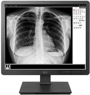 LG 19HK312C-B - Monitory - miniaturka - grafika 2