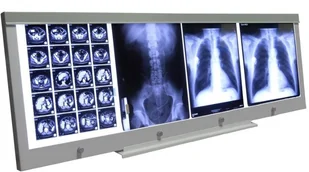 Ultra-Viol Sp.j NGP-41 Ultra Slim LED negatoskop biurkowy z ekranem 144x43cm LED NGP 41 biurko - Meble i wyposażenie gabinetów medycznych Ultra-Viol Sp.j NGP-41 Ultra Slim LED negatoskop biurkowy z ekranem 144x43cm LED NGP 41 biurko - Meble i wyposażenie gabinetów medycznych - miniaturka - grafika 1