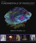 Przewodniki - Novelline Robert A. Squire's Fundamentals of Radiology - miniaturka - grafika 1