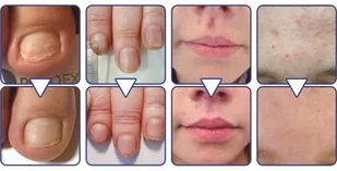 ARKADA Arkada TC16 Serum kolagenowe 11ml+maść AArkada 70g 10805-uniw - Pozostałe akcesoria kosmetyczne - miniaturka - grafika 4