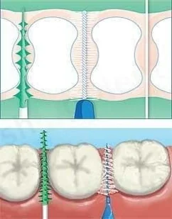 TePe TePe Original - Szczoteczki międzyzębowe 0,45 mm - pomarańczowe 8 szt - Szczoteczki międzyzębowe - miniaturka - grafika 3